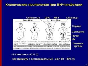 Может ли болеть селезенка при вич