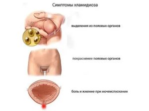 Можно ли заразиться венерическими от мочи