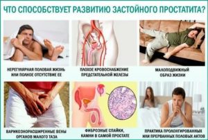 Признаки конгестивного простатита что это такое