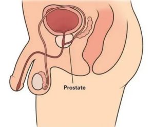 Почему при массаже простаты не выделяется секрет простаты