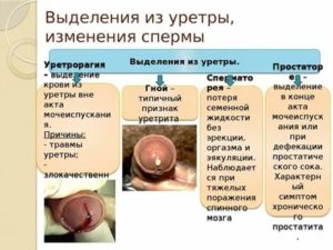 Выделения из мочеиспускательного канала у мужчин при простатите