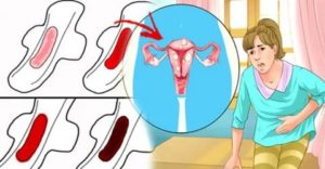 Как сделать чтобы не было месячных один месяц в домашних условиях