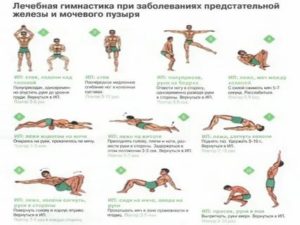 Упражнения при хроническом простатите кегеля