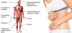 Почему болит печень может это вич