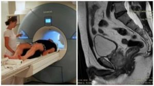 Мрт омт предстательной железы с контрастированием как готовиться к нему
