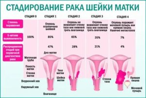 Можно ли заразиться раком шейки матки через общего партнера