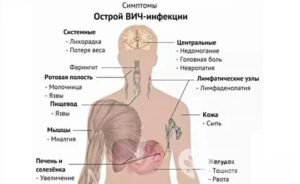 Как проявляется усталость при вич