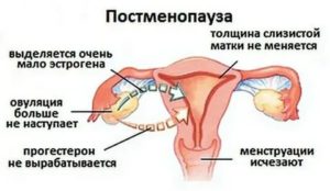 Как запустить работу яичников при менопаузе