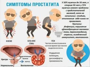При воспалении предстательной железы может подниматься температура