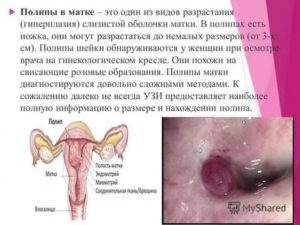 Может ли эндометриоз стать причиной замершей беременности