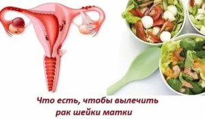 Что можно есть при онкологических заболеваниях шейки матки