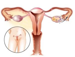 Что происходит с яичниками перед месячными
