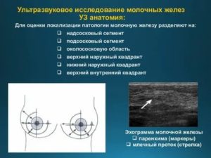 Презентация по узи молочных желез