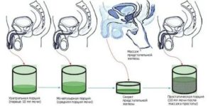 Почему при массаже простаты не выделяется секрет простаты