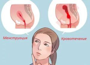 Почему когда тужишься месячные сильнее