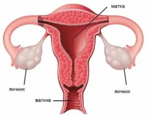 Бесплодие при детской матке