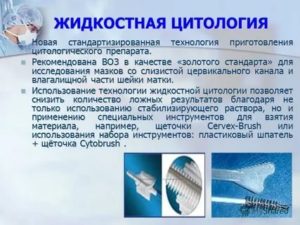 Что показывает жидкостная цитология шейки матки отзывы