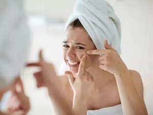 Как избавиться от прыщей во время месячных в домашних условиях