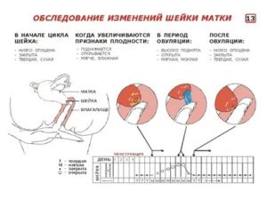 Шейка матки положение при климаксе