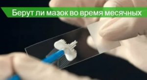 Когда лучше сдавать мазок на флору до месячных или после месячных