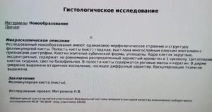 Гистология в гинекологии. Гистологическое исследование кисты яичника. Гистологическое исследование заключение. Результат гистологии кисты яичника. Результат гистологического исследования.