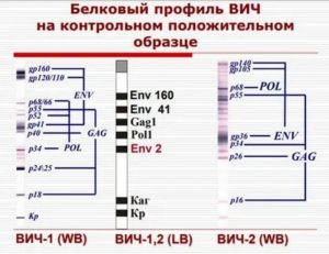 Может ли ошибаться иммуноблот на вич