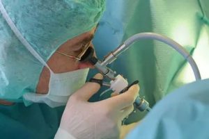 Сколько длится операция по удалению аденомы предстательной железы