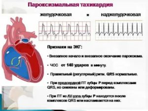 Почему перед месячными сердце сбивается с ритма