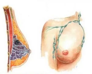 К чему снится опухоль на молочной железе