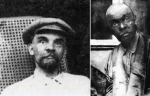 Кто заразил ленина сифилисом