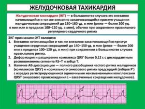 Можно ли делать кардиограмму во время месячных