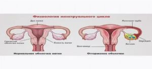 Сколько болит грудь еще во время месячных