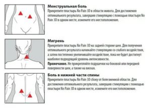 Что делать если болит низ живота и поясница после месячных