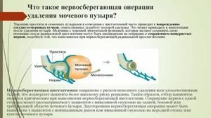 После удаления мочевого пузыря простаты и уретры остается мужчина мужчиной