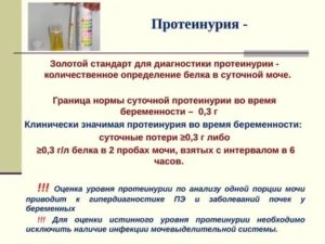 Протеинурия диагностика и лечение