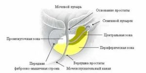 Простата формирование третьей доли что это такое