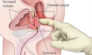Стимуляция уздечки и простаты
