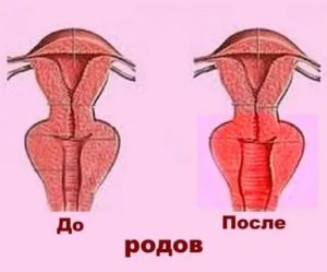 Как называется операция по уменьшению влагалища