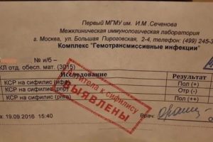 Может ли общий анализ крови показать наличие сифилиса