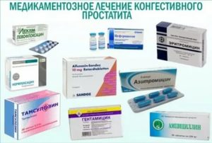 Признаки конгестивного простатита что это такое