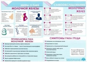 Санбюллетень что такое рак молочной железы