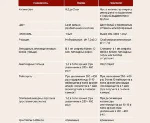 Каким должен цветом быть сок с простаты