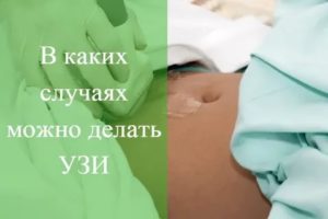 Можно ли идти на узи в последний день месячных