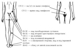 Какую точку массировать при цистите