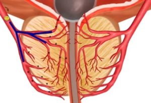 Как улучшить кровоснабжение в простате