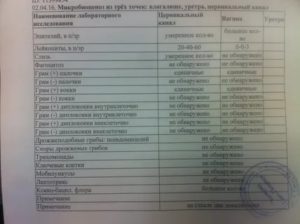 Можно по мазку на флору определить венерические заболевания