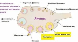 Узи признаки недостаточности желтого тела при беременности