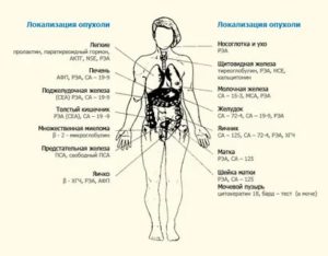 Как правильно сдать онкомаркеры по гинекологии