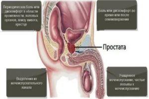 Могут ли болеть ноги при хроническом простатите