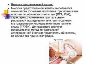 Почему после биопсии предстательной железы кровь в моче